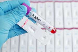 Helicobacter pylori: Eine Ursache der Ulkuskrankheit