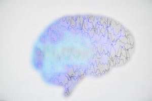 Hirnimplantat als Frühwarnsystem bei Epilepsie
