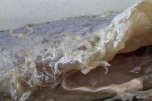 Anisakiasis: Wenn Würmer auf dem Fisch krabbeln