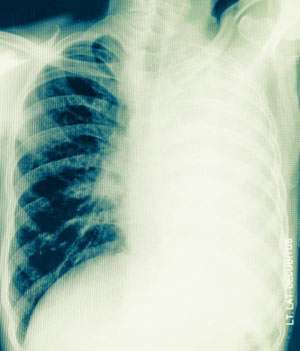 Atemnot (Dyspnoe): Diagnose