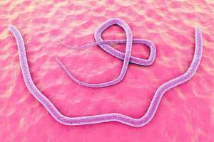 Askariasis: Wurminfektion des Darmes